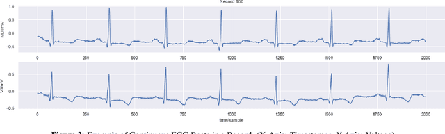 Figure 3 for Development of Interpretable Machine Learning Models to Detect Arrhythmia based on ECG Data