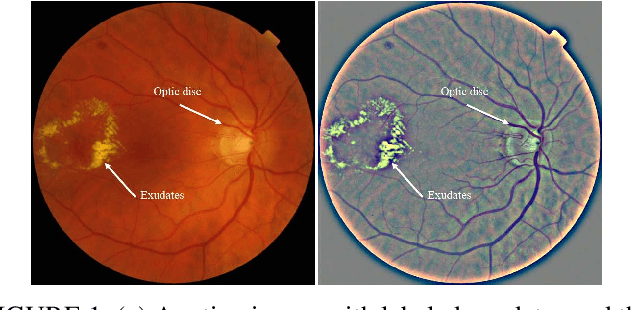 Figure 1 for W-net: Simultaneous segmentation of multi-anatomical retinal structures using a multi-task deep neural network