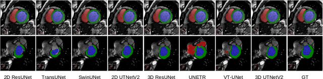 Figure 2 for A Multi-scale Transformer for Medical Image Segmentation: Architectures, Model Efficiency, and Benchmarks
