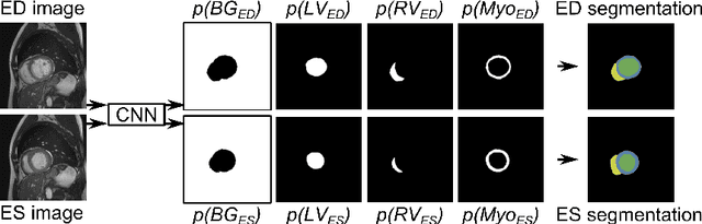 Figure 1 for Automatic Segmentation and Disease Classification Using Cardiac Cine MR Images