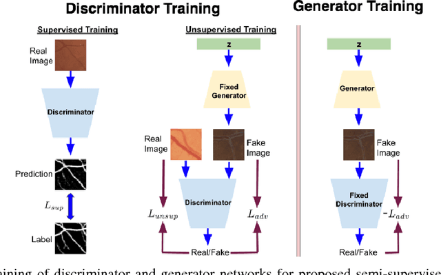 Figure 1 for Retinal Vessel Segmentation under Extreme Low Annotation: A Generative Adversarial Network Approach