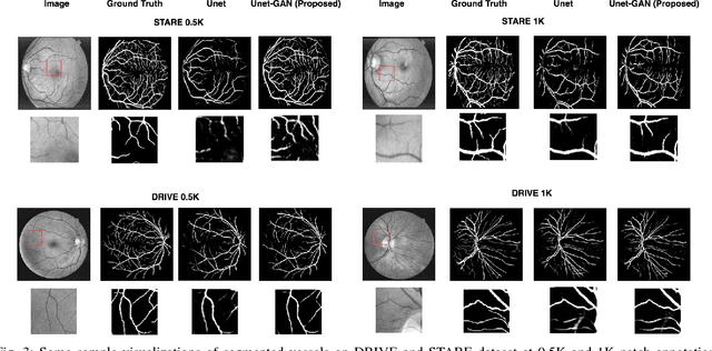 Figure 3 for Retinal Vessel Segmentation under Extreme Low Annotation: A Generative Adversarial Network Approach