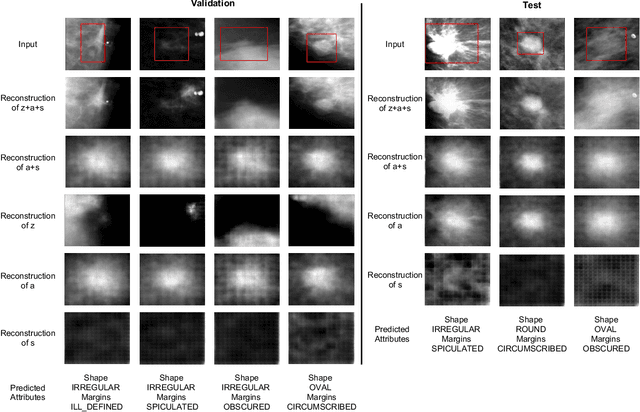 Figure 4 for Domain Invariant Model with Graph Convolutional Network for Mammogram Classification