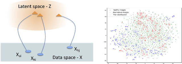 Figure 1 for Unsupervised Detection of Lesions in Brain MRI using constrained adversarial auto-encoders