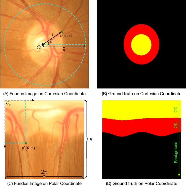 Figure 3 for Joint Optic Disc and Cup Segmentation Based on Multi-label Deep Network and Polar Transformation
