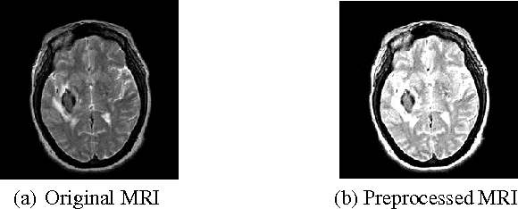 Figure 1 for Multi-level SVM Based CAD Tool for Classifying Structural MRIs