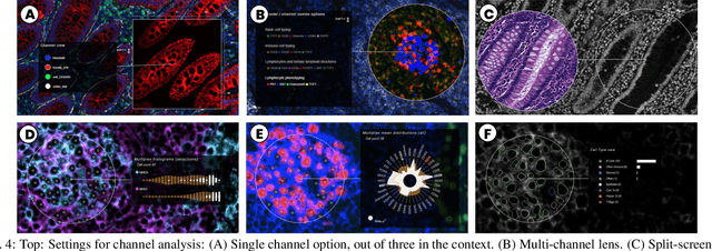 Figure 3 for Scope2Screen: Focus+Context Techniques for Pathology Tumor Assessment in Multivariate Image Data