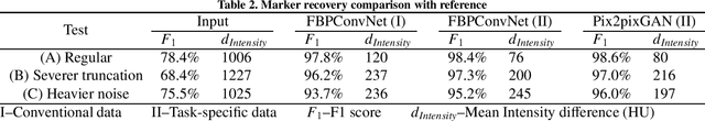 Figure 4 for Fiducial marker recovery and detection from severely truncated data in navigation assisted spine surgery