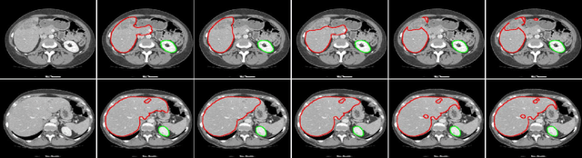 Figure 4 for CNN in CT Image Segmentation: Beyound Loss Function for Expoliting Ground Truth Images