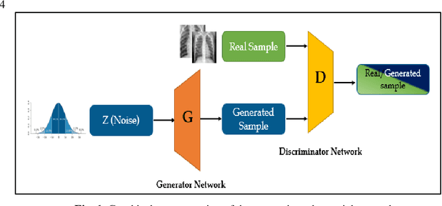 Figure 1 for Detection of Coronavirus (COVID-19) Associated Pneumonia based on Generative Adversarial Networks and a Fine-Tuned Deep Transfer Learning Model using Chest X-ray Dataset