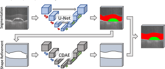 Figure 3 for Segmentation of Retinal Low-Cost Optical Coherence Tomography Images using Deep Learning