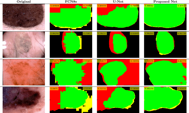 Figure 4 for DSNet: Automatic Dermoscopic Skin Lesion Segmentation