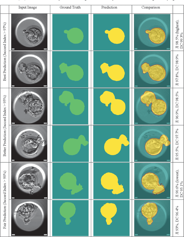 Figure 4 for Image Segmentation of Zona-Ablated Human Blastocysts