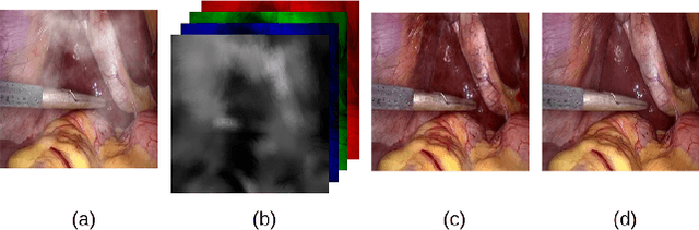 Figure 1 for Desmoking laparoscopy surgery images using an image-to-image translation guided by an embedded dark channel
