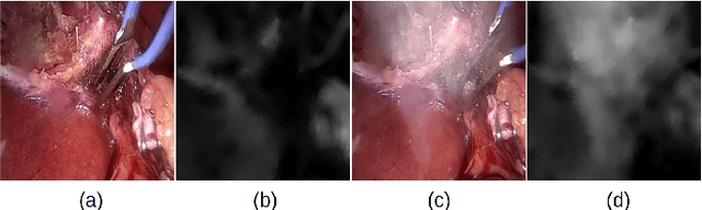 Figure 4 for Desmoking laparoscopy surgery images using an image-to-image translation guided by an embedded dark channel