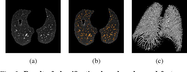 Figure 3 for Automated Multiscale 3D Feature Learning for Vessels Segmentation in Thorax CT Images