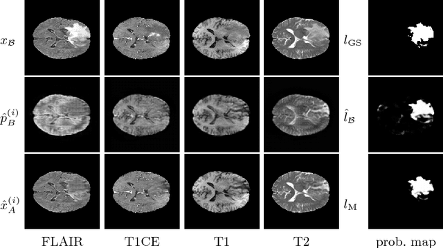 Figure 4 for Pathology Segmentation using Distributional Differences to Images of Healthy Origin