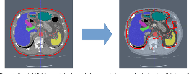 Figure 1 for An application of cascaded 3D fully convolutional networks for medical image segmentation