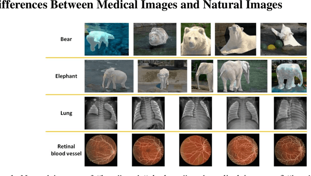 Figure 1 for Cutting-Splicing data augmentation: A novel technology for medical image segmentation