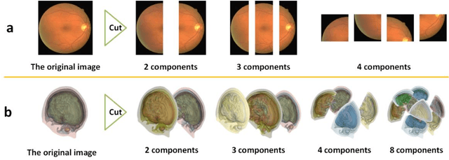 Figure 3 for Cutting-Splicing data augmentation: A novel technology for medical image segmentation