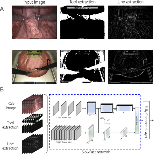 Figure 4 for Surgical Visual Domain Adaptation: Results from the MICCAI 2020 SurgVisDom Challenge