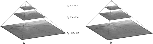 Figure 2 for Automatic Identification of the End-Diastolic and End-Systolic Cardiac Frames from Invasive Coronary Angiography Videos