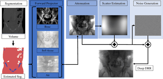 Figure 1 for DeepDRR -- A Catalyst for Machine Learning in Fluoroscopy-guided Procedures
