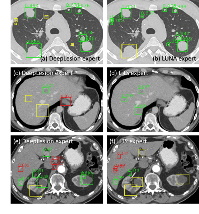 Figure 3 for Learning from Multiple Datasets with Heterogeneous and Partial Labels for Universal Lesion Detection in CT