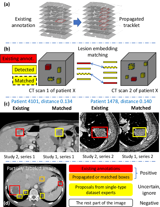 Figure 4 for Learning from Multiple Datasets with Heterogeneous and Partial Labels for Universal Lesion Detection in CT
