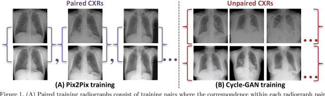Figure 1 for Bone Suppression on Chest Radiographs With Adversarial Learning