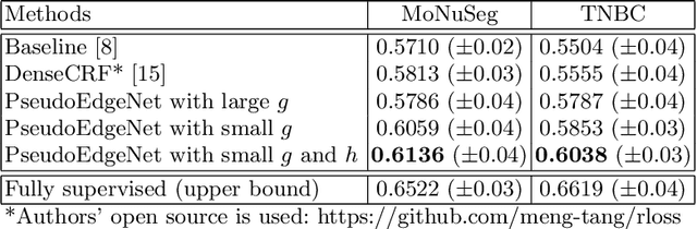 Figure 2 for PseudoEdgeNet: Nuclei Segmentation only with Point Annotations