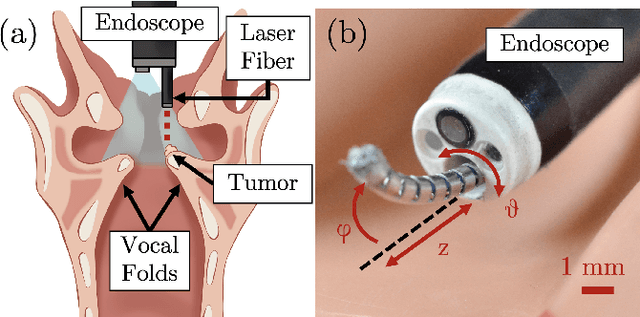 Figure 1 for Light in the Larynx: a Miniaturized Robotic Optical Fiber for In-office Laser Surgery of the Vocal Folds