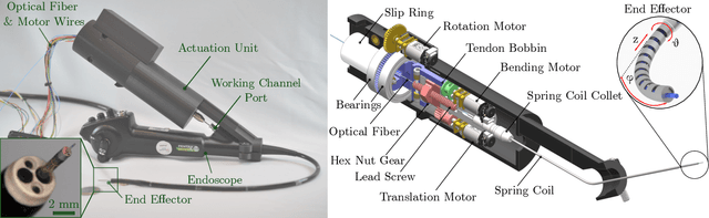 Figure 4 for Light in the Larynx: a Miniaturized Robotic Optical Fiber for In-office Laser Surgery of the Vocal Folds