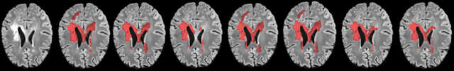 Figure 1 for A Soft STAPLE Algorithm Combined with Anatomical Knowledge