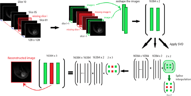 Figure 3 for A Novel Data-Driven Method for the Analysis and Reconstruction of Cardiac Cine MRI