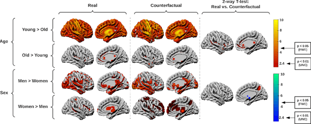 Figure 3 for Equitable modelling of brain imaging by counterfactual augmentation with morphologically constrained 3D deep generative models