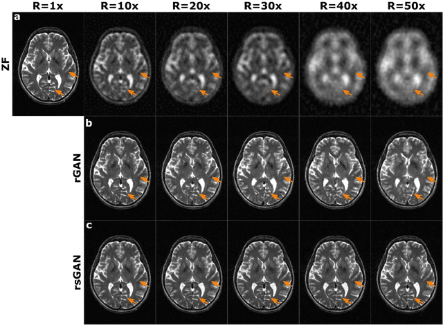 Figure 3 for Synergistic Reconstruction and Synthesis via Generative Adversarial Networks for Accelerated Multi-Contrast MRI