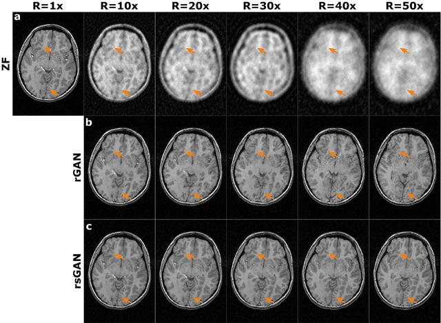 Figure 4 for Synergistic Reconstruction and Synthesis via Generative Adversarial Networks for Accelerated Multi-Contrast MRI