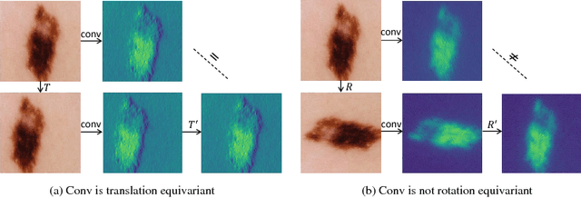Figure 1 for Deeply Supervised Rotation Equivariant Network for Lesion Segmentation in Dermoscopy Images