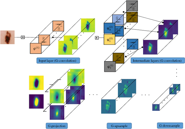 Figure 3 for Deeply Supervised Rotation Equivariant Network for Lesion Segmentation in Dermoscopy Images