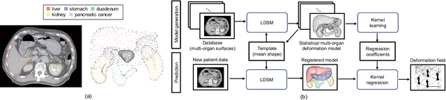 Figure 4 for Statistical Deformation Reconstruction Using Multi-organ Shape Features for Pancreatic Cancer Localization
