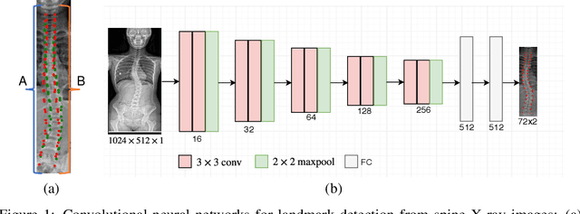 Figure 1 for Bipartite Distance for Shape-Aware Landmark Detection in Spinal X-Ray Images