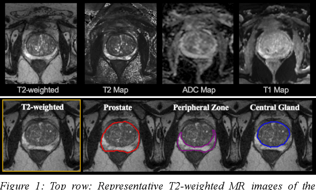 Figure 1 for A Cascaded Residual UNET for Fully Automated Segmentation of Prostate and Peripheral Zone in T2-weighted 3D Fast Spin Echo Images