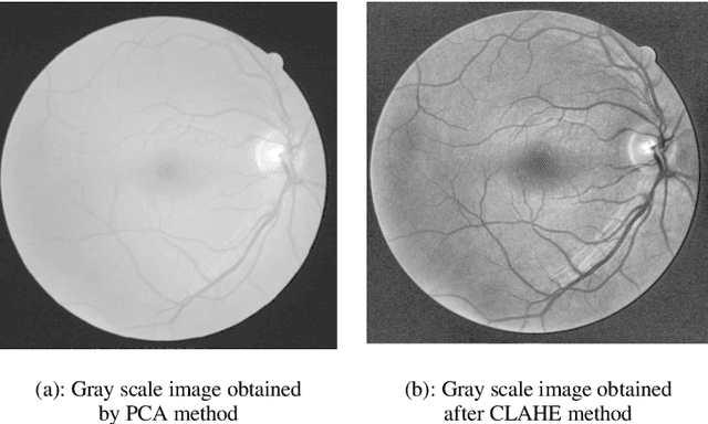 Figure 3 for Efficient Kernel based Matched Filter Approach for Segmentation of Retinal Blood Vessels