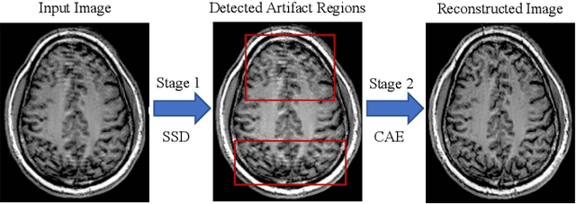 Figure 1 for Localized Motion Artifact Reduction on Brain MRI Using Deep Learning with Effective Data Augmentation Techniques