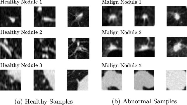 Figure 1 for Anomaly Detection for imbalanced datasets with Deep Generative Models