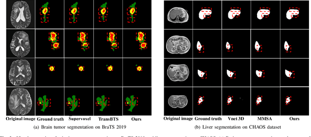 Figure 3 for MISSU: 3D Medical Image Segmentation via Self-distilling TransUNet
