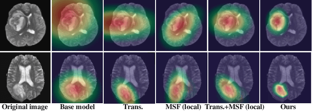 Figure 4 for MISSU: 3D Medical Image Segmentation via Self-distilling TransUNet