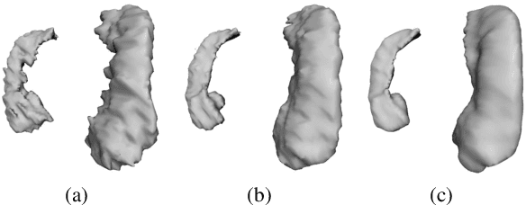 Figure 1 for Shape-Aware Organ Segmentation by Predicting Signed Distance Maps