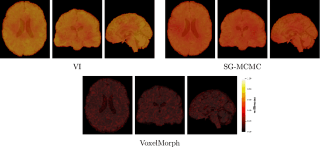 Figure 4 for Uncertainty quantification in non-rigid image registration via stochastic gradient Markov chain Monte Carlo